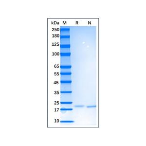 Recombinant Human IL-6 Protein,Recombinant Human IL-6 Protein