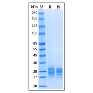 Recombinant Human IL-9 Protein,Recombinant Human IL-9 Protein