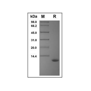 Recombinant Human CCL15 Protein,Recombinant Human CCL15 Protein