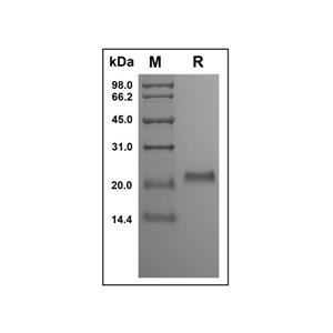 Recombinant Human Osteoprotegerin Protein,Recombinant Human Osteoprotegerin Protein