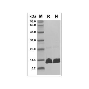 Recombinant Human Parathyroid Hormone Protein,Recombinant Human Parathyroid Hormone Protein