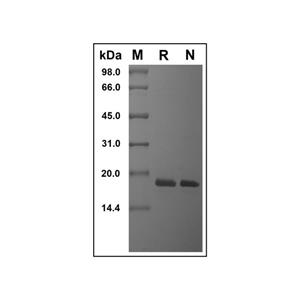 Recombinant Human PTN Protein,Recombinant Human PTN Protein