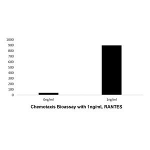 aladdin 阿拉丁 rp150860 Recombinant Human RANTES Protein Animal Free, >98%(SDS-PAGE, HPLC), Active, E.coli, No tag, 24-91 aa