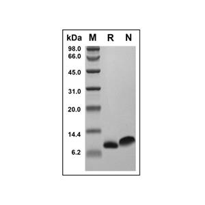 Recombinant Human RANTES Protein,Recombinant Human RANTES Protein