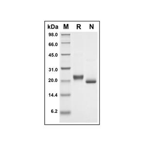 Recombinant Human TNFRSF1A Protein,Recombinant Human TNFRSF1A Protein