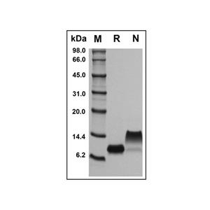 Recombinant Mouse CXCL10/IP-10 Protein,Recombinant Mouse CXCL10/IP-10 Protein