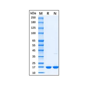 aladdin 阿拉丁 rp154118 Recombinant Mouse IL-1 beta Protein Animal Free, >95%(SDS-PAGE), Active, E.coli, His tag, 118-269 aa