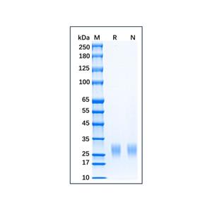 Recombinant Mouse IL-2 Protein,Recombinant Mouse IL-2 Protein