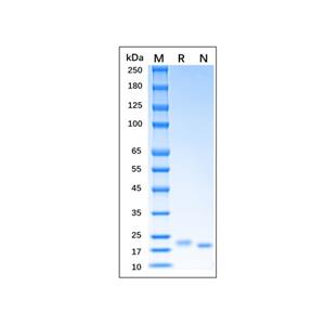 Recombinant Mouse IL-6 Protein,Recombinant Mouse IL-6 Protein