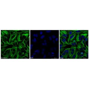 beta Tubulin Mouse mAb,beta Tubulin Mouse mAb