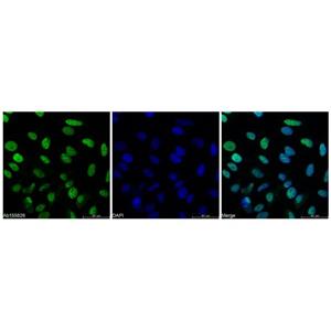 PCNA Mouse mAb,PCNA Mouse mAb