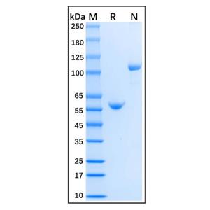 Recombinant Mouse TRANCE/RANKL/TNFSF11 Protein,Recombinant Mouse TRANCE/RANKL/TNFSF11 Protein