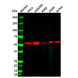 Vimentin Mouse mAb,Vimentin Mouse mAb