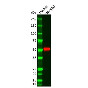 Vimentin Mouse mAb,Vimentin Mouse mAb