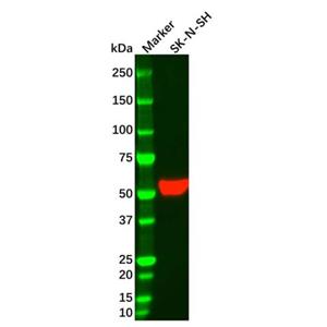 Vimentin Mouse mAb,Vimentin Mouse mAb