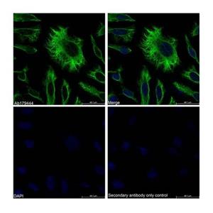 Vimentin Mouse mAb,Vimentin Mouse mAb