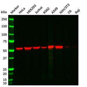 Vimentin Mouse mAb,Vimentin Mouse mAb