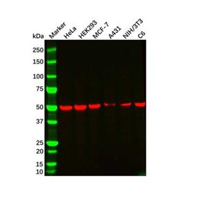 beta Tubulin Mouse mAb,beta Tubulin Mouse mAb