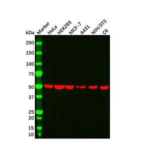 beta Tubulin Mouse mAb,beta Tubulin Mouse mAb