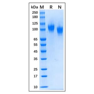 Recombinant Human NCAM-1/CD56 Protein,Recombinant Human NCAM-1/CD56 Protein