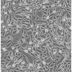 RM-1小鼠前列腺癌细胞