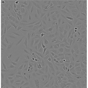 大鼠嗜碱性细胞白血病细胞