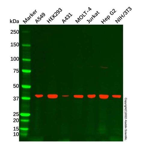 ACAT1 Antibody,ACAT1 Antibody