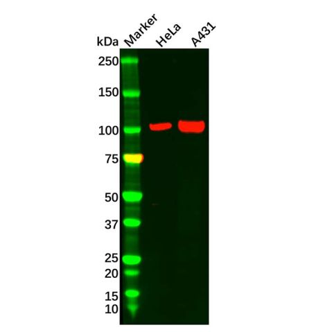 CTNNA1 Antibody,CTNNA1 Antibody