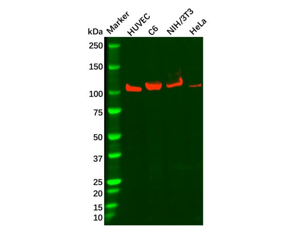 Recombinant Drebrin Antibody,Recombinant Drebrin Antibody