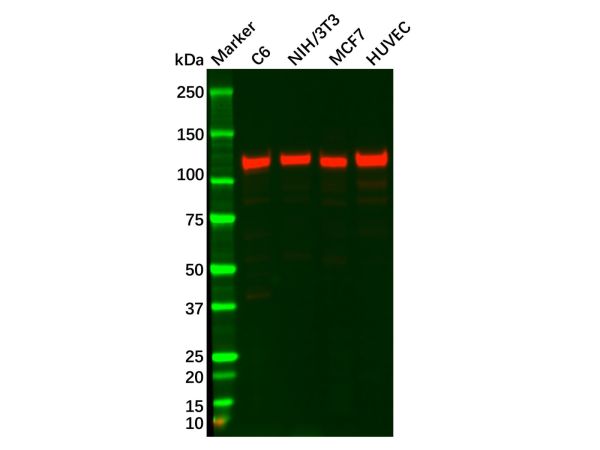 FAK Antibody,FAK Antibody