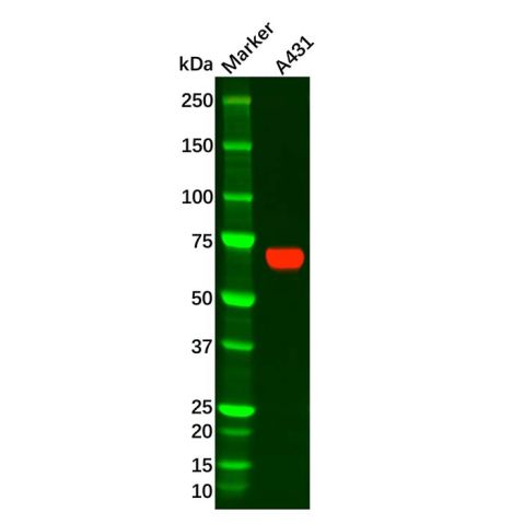 Placental alkaline phosphatase (PLAP) Antibody,Placental alkaline phosphatase (PLAP) Antibody