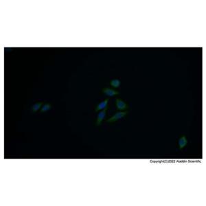 ACAT1 Antibody,ACAT1 Antibody