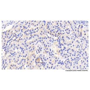 ACAT1 Antibody,ACAT1 Antibody