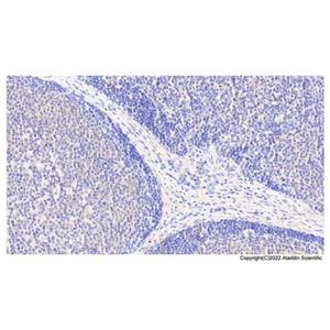 ACAT1 Antibody,ACAT1 Antibody