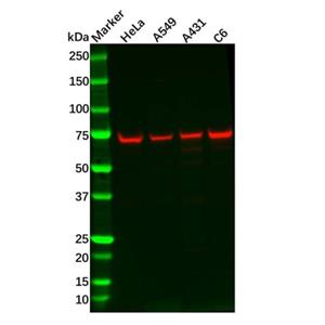 Recombinant ATP6V1A Antibody,Recombinant ATP6V1A Antibody