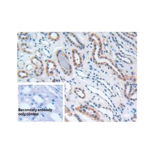 CD276 Antibody,CD276 Antibody