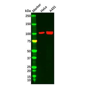 CTNNA1 Antibody,CTNNA1 Antibody