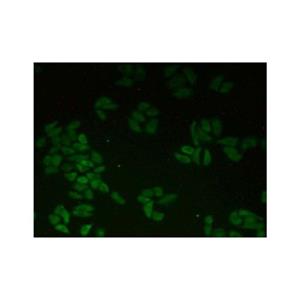 CTNNA1 Antibody,CTNNA1 Antibody