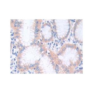 CTNNA1 Antibody,CTNNA1 Antibody