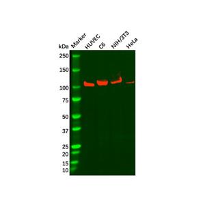 aladdin 阿拉丁 Ab100490 Recombinant Drebrin Antibody Recombinant (R06-1A2); Rabbit anti Human Drebrin Antibody; WB; Unconjugated