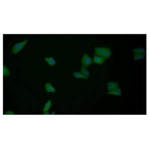 Galectin 3 Antibody,Galectin 3 Antibody