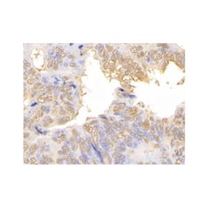 Galectin 3 Antibody,Galectin 3 Antibody