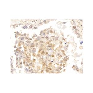 Galectin 3 Antibody,Galectin 3 Antibody