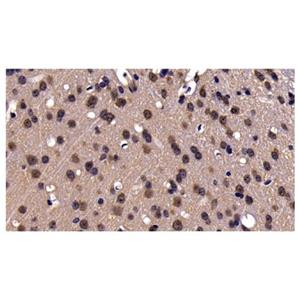 GRP94 Antibody,GRP94 Antibody