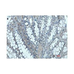 Recombinant Ihh Antibody,Recombinant Ihh Antibody