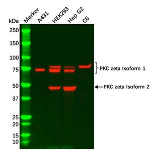 aladdin 阿拉丁 Ab122119 PKC zeta Antibody pAb; Rabbit anti Human PKC zeta Antibody; WB, IHC; Unconjugated