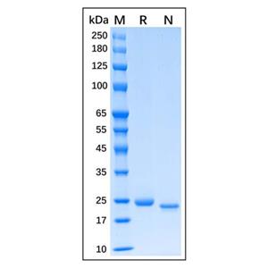 Native Human C-Reactive Protein,Native Human C-Reactive Protein