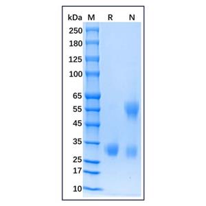 Recombinant Human Adiponectin/Acrp30 Protein,Recombinant Human Adiponectin/Acrp30 Protein