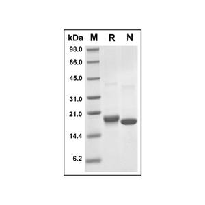 Recombinant Human ARMET/ARP Protein,Recombinant Human ARMET/ARP Protein