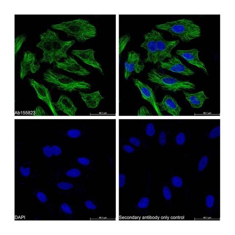 Streptavidin protein (FITC),Streptavidin protein (FITC)